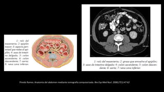 Pinedo Ramos. Anatomía del abdomen mediante tomografía computarizada. Rev Esp Med Nucl. 2008;27(1):47-62
 