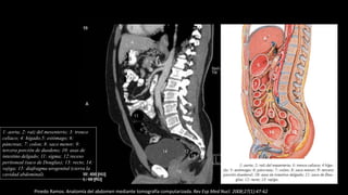 1: aorta; 2: raíz del mesenterio; 3: tronco
celiaco; 4: hígado;5: estómago; 6:
páncreas; 7: colon; 8: saco menor; 9:
tercera porción de duodeno; 10: asas de
intestino delgado; 11: sigma; 12:receso
peritoneal (saco de Douglas); 13: recto; 14:
vejiga; 15: diafragma urogenital (cierra la
cavidad abdominal).
Pinedo Ramos. Anatomía del abdomen mediante tomografía computarizada. Rev Esp Med Nucl. 2008;27(1):47-62
 