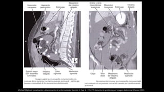 Michael Oliphant. Localización y diseminación de enfermedades. Sección II. Cap. 6 . 119-139.Solución de problemas en imagen abdominal. Elseiver 2011
 