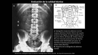 A. Radiografía simple de abdomen normal.
La grasa delimita el borde inferior de la parte
posterior del hígado, el ángulo hepático (H) y
la parte inferior del bazo (B). Ambos riñones
(R) y los músculos psoas (puntas de flecha)
también están delimitados por grasa. Se
identifica la banda grasa properitoneal a
ambos lados (flechas).
B. Diagrama de la radiografía de abdomen
normal.
Michael Chen. Radiografía simple de abdomen. Radiología básica. Parte 4: 223-244 Mc Graw-Hill-Interamericana. 2006
A B
Evaluación de la calidad técnica
 