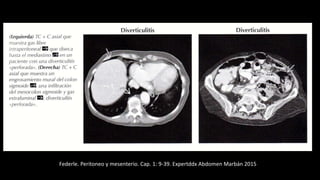 Federle. Peritoneo y mesenterio. Cap. 1: 9-39. Expertddx Abdomen Marbán 2015
 