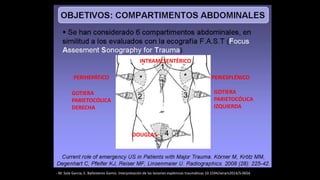 PERIHEPÁTICO PERIESPLÉNICO
GOTIERA
PARIETOCÓLICA
DERECHA
GOTIERA
PARIETOCÓLICA
IZQUIERDA
DOUGLAS
INTRAMESENTÉRICO
- M. Sola Garcia, E. Ballesteros Gomiz. Interpretación de las lesiones esplénicas traumáticas 10.1594/seram2014/S-0656
 