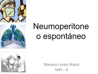 Neumoperitone
o espontáneo
Mariana Loreto Brand
MIR – II
 