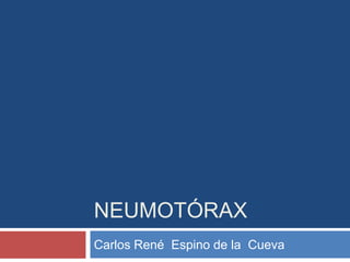 neumotórax Carlos René  Espino de la  Cueva 
