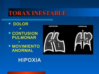 TORAX INESTABLE
   DOLOR
      +
 CONTUSION
    PULMONAR
      +
 MOVIMIENTO
    ANORMAL

      HIPOXIA
 