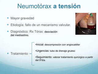 Neumotórax a tensión
 Mayor gravedad
 Etiología: fallo de un mecanismo valvular.
 Diagnóstico: Rx Tórax: desviación
  del mediastino.


                    •Inicial: descompresión con angiocatéter

                    •Urgencias: tubo de drenaje grueso
 Tratamiento
                    •Seguimiento: valorar tratamiento quirúrgico a partir
                    del 5ºdía.
 