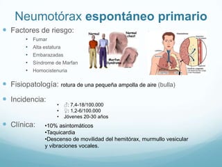 Neumotórax espontáneo primario
 Factores de riesgo:
        •   Fumar
        •   Alta estatura
        •   Embarazadas
        •   Síndrome de Marfan
        •   Homocistenuria

 Fisiopatología: rotura de una pequeña ampolla de aire (bulla)
 Incidencia:
                       •    ♂: 7,4-18/100.000
                       •    ♀: 1,2-6/100.000
                       •    Jóvenes 20-30 años
 Clínica:       •10% asintomáticos
                 •Taquicardia
                 •Descenso de movilidad del hemitórax, murmullo vesicular
                 y vibraciones vocales.
 