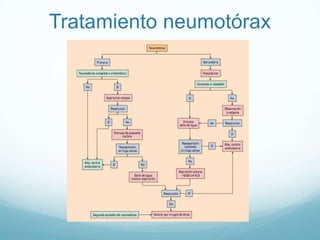 Tratamiento neumotórax
 