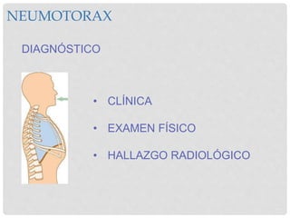 NEUMOTORAX
DIAGNÓSTICO
• CLÍNICA
• EXAMEN FÍSICO
• HALLAZGO RADIOLÓGICO
 