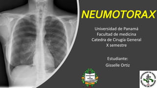 NEUMOTORAX
Universidad de Panamá
Facultad de medicina
Catedra de Cirugía General
X semestre
Estudiante:
Gisselle Ortiz
 