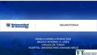 ANGELA DANIELA ROSAS DIAZ
MEDICO INTERNO I1- UDES
CIRUGIA DE TORAX
HOSPITAL UNIVERSITARIO ERASMO MEOZ
NEUMOTORAX
 