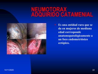 14/11/2020 22
NEUMOTORAX
ADQUIRIDO CATAMENIAL
 Es una entidad rara que se
da en mujeres de mediana
edad corresponde
anatomopatológicamente a
un foco endometriósico
ectópico.
 