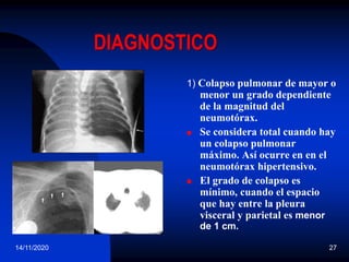 14/11/2020 27
DIAGNOSTICO
1) Colapso pulmonar de mayor o
menor un grado dependiente
de la magnitud del
neumotórax.
 Se considera total cuando hay
un colapso pulmonar
máximo. Así ocurre en en el
neumotórax hipertensivo.
 El grado de colapso es
mínimo, cuando el espacio
que hay entre la pleura
visceral y parietal es menor
de 1 cm.
 