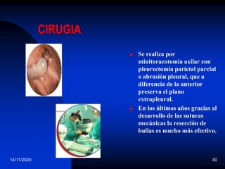 14/11/2020 40
CIRUGIA
 Se realiza por
minitoracotomía axilar con
pleurectomía parietal parcial
o abrasión pleural, que a
diferencia de la anterior
preserva el plano
extrapleural.
 En los últimos años gracias al
desarrollo de las suturas
mecánicas la resección de
bullas es mucho más efectivo.
 