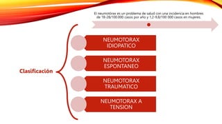 El neumotórax es un problema de salud con una incidencia en hombres
de 18-28/100.000 casos por año y 1,2-9,8/100 000 casos en mujeres.
Clasificación
NEUMOTORAX
IDIOPATICO
NEUMOTORAX
ESPONTANEO
NEUMOTORAX
TRAUMATICO
NEUMOTORAX A
TENSION
 