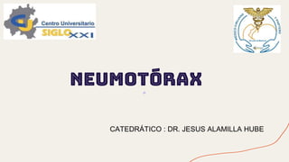 NEUMOTÓRAX
CATEDRÁTICO : DR. JESUS ALAMILLA HUBE
 