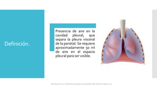 Definición.
Presencia de aire en la
cavidad pleural, que
separa la pleura visceral
de la parietal. Se requiere
aproximadamente 50 ml
de aire en el espacio
pleural para ser visible.
FIshman,A:P 2022, Pulmonary deseases and disordderes.Mc Graw Hill capitulo 79.
 