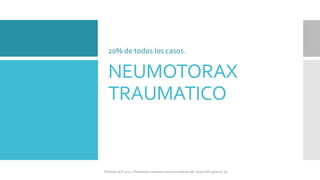 NEUMOTORAX
TRAUMATICO
20% de todos los casos.
FIshman,A:P 2022, Pulmonary deseases and disordderes.Mc Graw Hill capitulo 79.
 