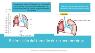 Estimación del tamaño de un neumotórax.
Diámetro de pulmón colapsado y del
hemitórax afectado y elevarlos al cubo.
Nomograma: Midiendo la distancia intrapleural
en el vértice y en los puntos medios de los
pulmones superior e inferior, se promedian los
tres valores
FIshman,A:P 2022, Pulmonary deseases and disordderes.Mc Graw Hill capitulo 79.
 
