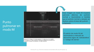 Punto
pulmonar en
modo M
Esta imagen en modo M muestra
patrones alternos de pulmón
normal y neumotórax a medida
que el pulmón normal y aireado se
desliza sobre el área del pulmón
colapsado.
El patrón de modo M del
neumotórax a menudo se
denomina signo de “estratosfera”
o “código de barras”
FIshman,A:P 2022, Pulmonary deseases and disordderes.Mc Graw Hill capitulo 79.
 