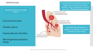 Comunicación entre:
Alveolo y pleura
Espacio pleural y Atmofera
Microorganismo productor
de gas
FISIOPATOLOGIA. La presión dentro del espacio pleural es
negativa con respecto a la presión
alveolar, tanto en inspiración como en
espiración. ( Presión transpulmonar)
La presión pleural también es
negativa con respecto a la presión
atmosférica. (760 mmhg)
Presencia de aire en la cavidad
pleural
FIshman,A:P 2022, Pulmonary deseases and disordderes.Mc Graw Hill capitulo 79.
 