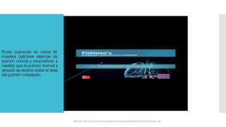 Punto pulmonar en modo M.
muestra patrones alternos de
pulmón normal y neumotórax a
medida que el pulmón normal y
aireado se desliza sobre el área
del pulmón colapsado.
FIshman,A:P 2022, Pulmonary deseases and disordderes.Mc Graw Hill capitulo 79.
 