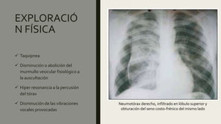 EXPLORACIÓ
N FÍSICA
 Taquipnea
 Disminución o abolición del
murmullo vesicular fisiológico a
la auscultación
 Híper resonancia a la percusión
del tórax
 Disminución de las vibraciones
vocales provocadas
Neumotórax derecho, infiltrado en lóbulo superior y
obturación del seno costo-frénico del mismo lado
 