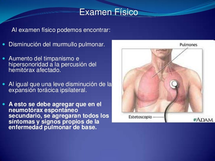 Neumotorax clase unpa 2011