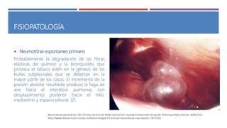 FISIOPATOLOGÍA
 Neumotórax espontaneo primario
Probablemente la degradación de las fibras
elásticas del pulmón y la bronquiolitis que
provoca el tabaco estén en la génesis de las
bullas subpleurales que se detectan en la
mayor parte de los casos. El incremento de la
presión alveolar resultante produce la fuga de
aire hacia el intersticio pulmonar, con
desplazamiento posterior hacia el hilio,
mediastino y espacio pleural. (2)
 