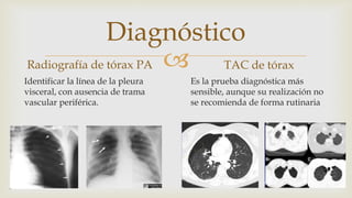 
Diagnóstico
Radiografía de tórax PA
Identificar la línea de la pleura
visceral, con ausencia de trama
vascular periférica.
TAC de tórax
Es la prueba diagnóstica más
sensible, aunque su realización no
se recomienda de forma rutinaria
 