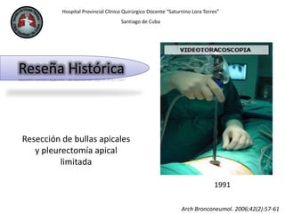 Hospital Provincial Clínico Quirúrgico Docente “Saturnino Lora Torres”
Santiago de Cuba
Reseña Histórica
Arch Bronconeumol. 2006;42(2):57-61
Resección de bullas apicales
y pleurectomía apical
limitada
1991
 