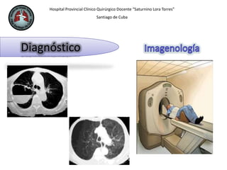 Hospital Provincial Clínico Quirúrgico Docente “Saturnino Lora Torres”
Santiago de Cuba
Diagnóstico
 