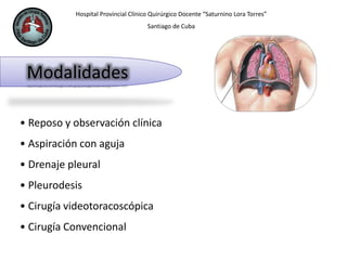 Hospital Provincial Clínico Quirúrgico Docente “Saturnino Lora Torres”
Santiago de Cuba
Modalidades
• Reposo y observación clínica
• Aspiración con aguja
• Drenaje pleural
• Pleurodesis
• Cirugía videotoracoscópica
• Cirugía Convencional
 