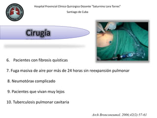 Hospital Provincial Clínico Quirúrgico Docente “Saturnino Lora Torres”
Santiago de Cuba
Cirugía
Arch Bronconeumol. 2006;42(2):57-61
6. Pacientes con fibrosis quísticas
7. Fuga masiva de aire por más de 24 horas sin reexpansión pulmonar
8. Neumotórax complicado
9. Pacientes que vivan muy lejos
10. Tuberculosis pulmonar cavitaria
 
