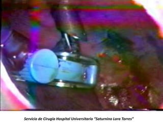 Servicio de Cirugía Hospital Universitario “Saturnino Lora Torres”
 