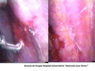 Servicio de Cirugía Hospital Universitario “Saturnino Lora Torres”
 