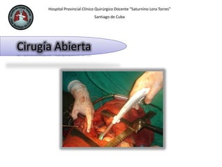 Hospital Provincial Clínico Quirúrgico Docente “Saturnino Lora Torres”
Santiago de Cuba
Cirugía Abierta
 