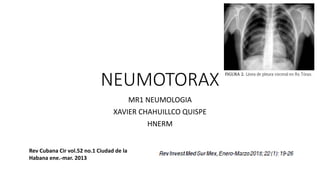 NEUMOTORAX
MR1 NEUMOLOGIA
XAVIER CHAHUILLCO QUISPE
HNERM
Rev Cubana Cir vol.52 no.1 Ciudad de la
Habana ene.-mar. 2013
 