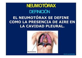 NEUMOTÓRAX
DEFINICIÓN
EL NEUMOTÓRAX SE DEFINE
COMO LA PRESENCIA DE AIRE EN
LA CAVIDAD PLEURAL.
Prof.Dr
.Luis del RioDiez
 