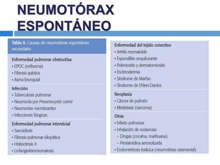NEUMOTÓRAX
ESPONTÁNEO
 