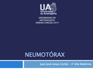 UNIVERSIDAD DE 
ANTOFAGASTA 
UNIDAD CIRUGÍA 2014 
NEUMOTÓRAX 
Juan José Araya Cortés – 4° Año Medicina 
 
