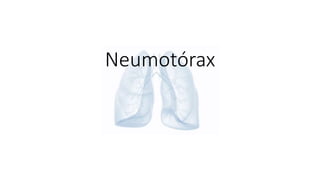 Neumotórax
 