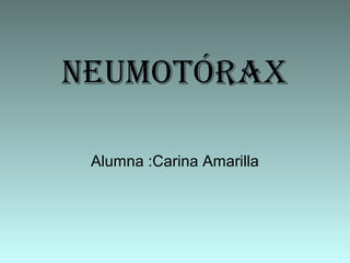 Neumotórax
Alumna :Carina Amarilla
 