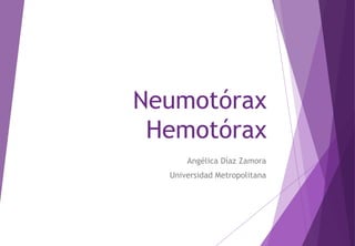 Neumotórax
Hemotórax
Angélica Díaz Zamora
Universidad Metropolitana
 