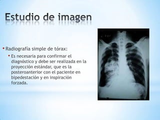 • Radiografía simple de tórax:
• Es necesaria para confirmar el
diagnóstico y debe ser realizada en la
proyección estándar, que es la
posteroanterior con el paciente en
bipedestación y en inspiración
forzada.
 