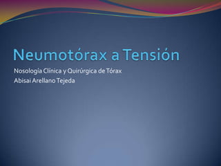 Nosología Clínica y Quirúrgica de Tórax
Abisai Arellano Tejeda
 