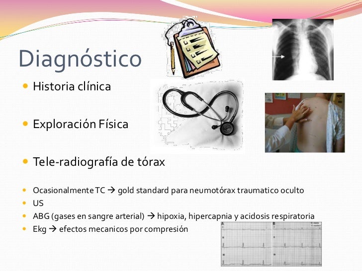 Neumotórax a tensión