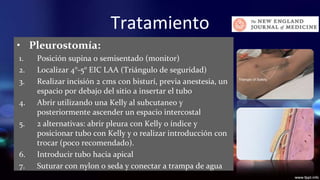 Tratamiento
• Pleurostomía:
1.
2.
3.
4.
5.

6.
7.

Posición supina o semisentado (monitor)
Localizar 4°-5° EIC LAA (Triángulo de seguridad)
Realizar incisión 2 cms con bisturí, previa anestesia, un
espacio por debajo del sitio a insertar el tubo
Abrir utilizando una Kelly al subcutaneo y
posteriormente ascender un espacio intercostal
2 alternativas: abrir pleura con Kelly o índice y
posicionar tubo con Kelly y o realizar introducción con
trocar (poco recomendado).
Introducir tubo hacia apical
Suturar con nylon o seda y conectar a trampa de agua

 