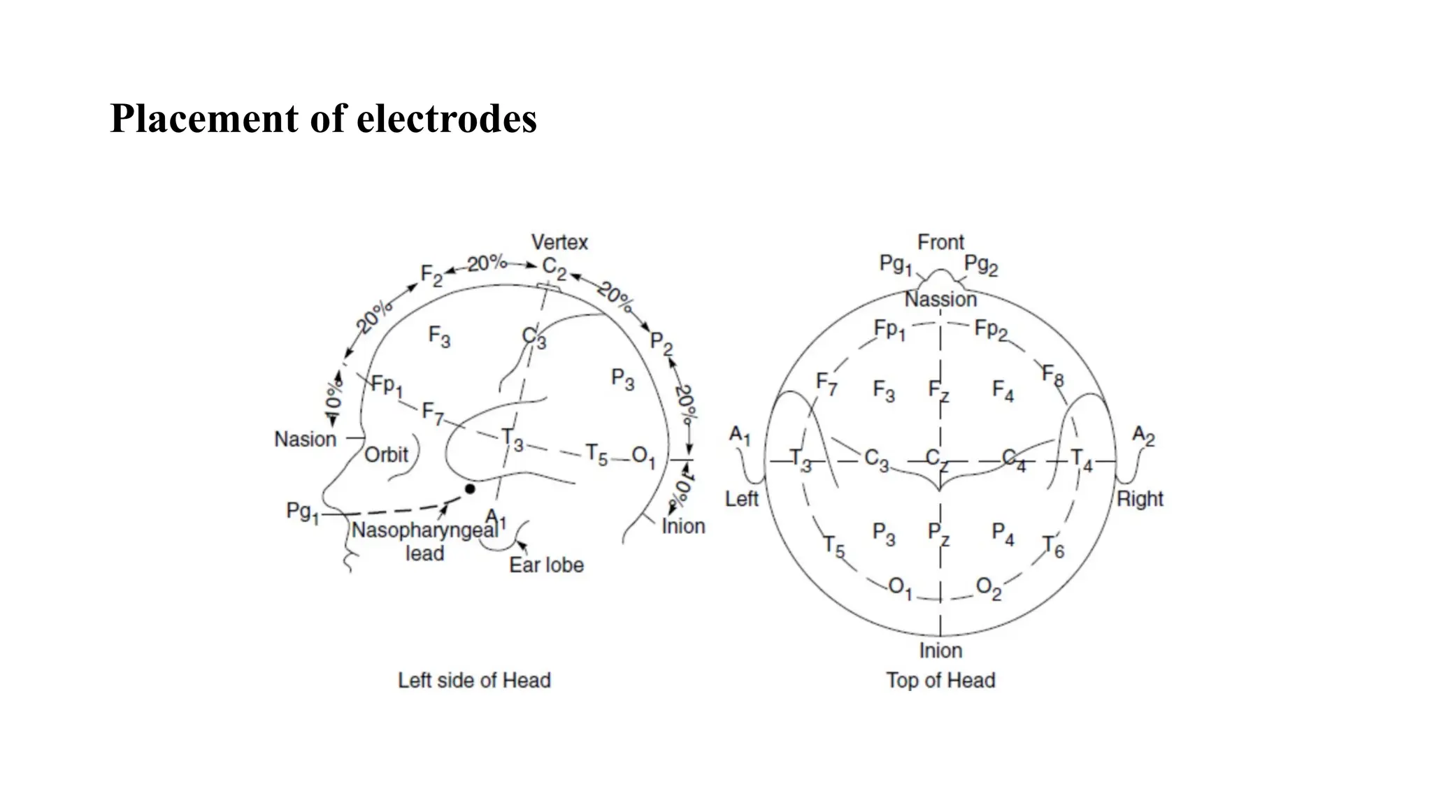 Placement of electrodes
 