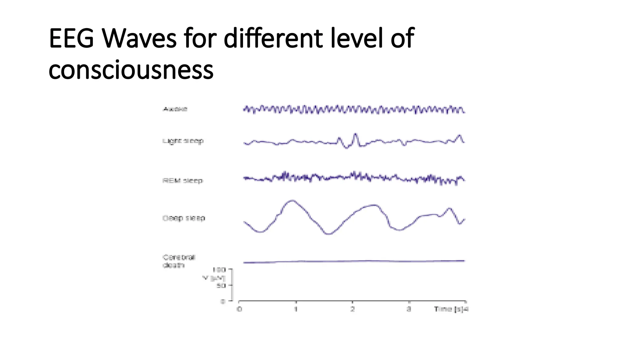 EEG Waves for different level of
consciousness
 